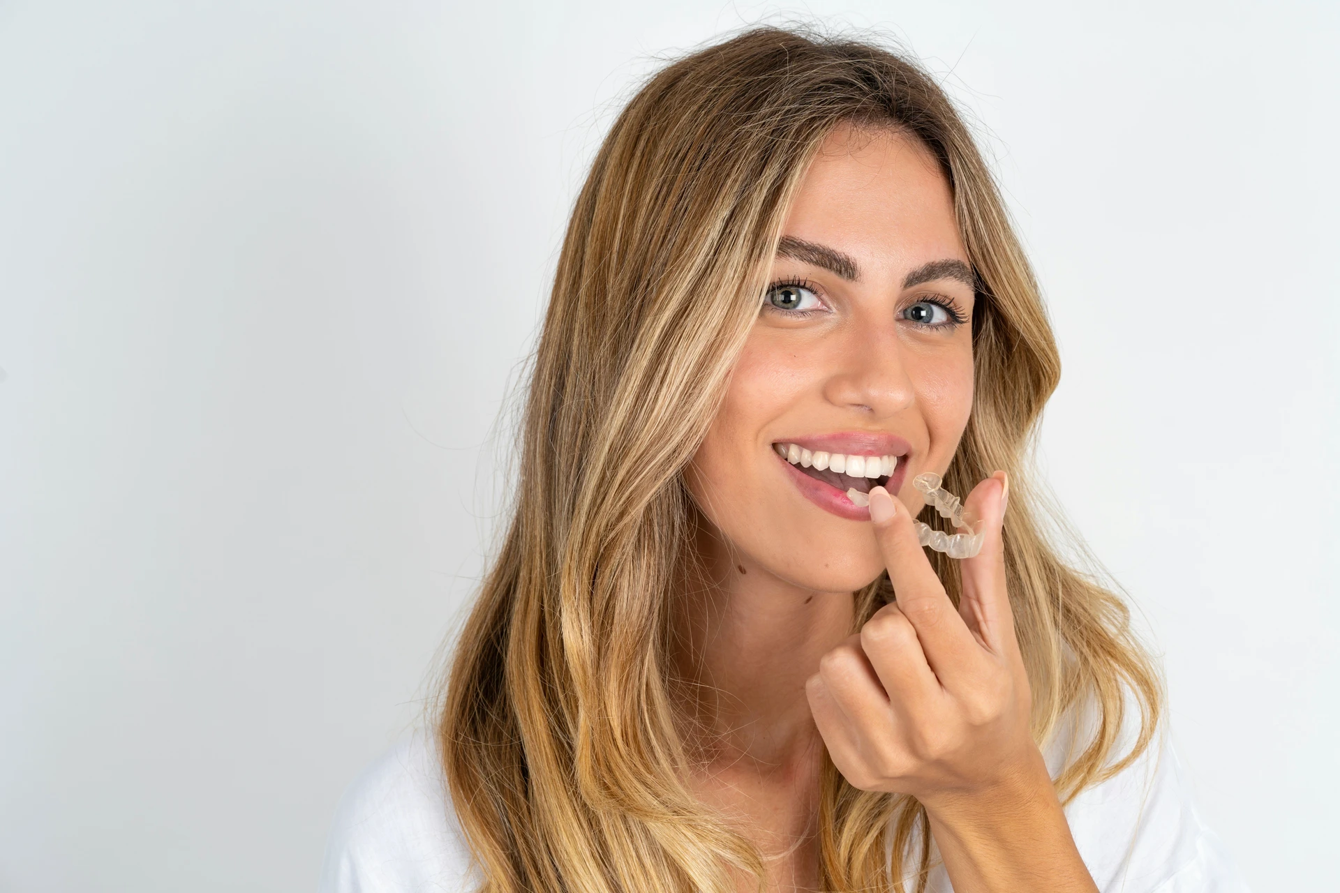 Orthodontics for adults