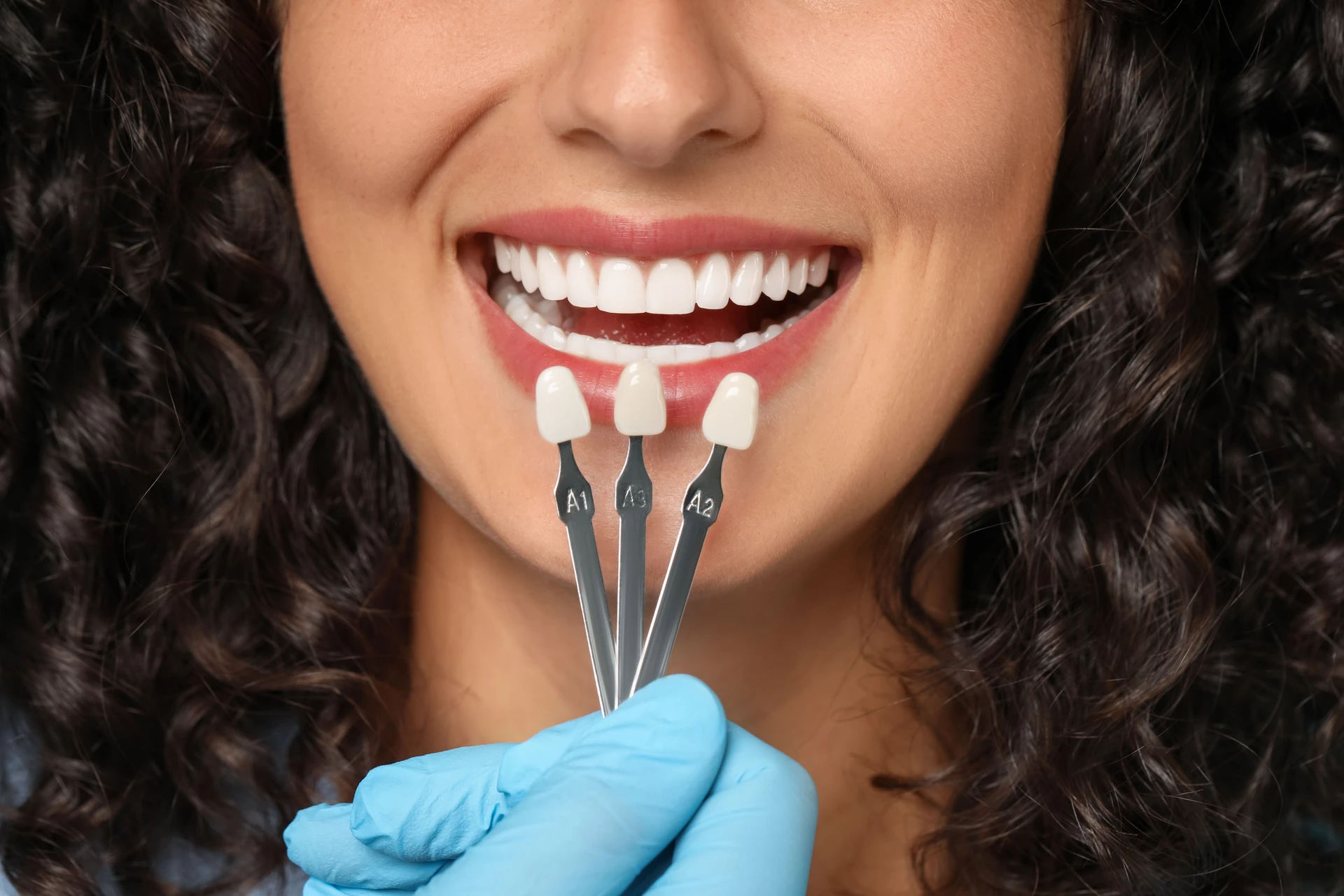 Cosmetic smile results