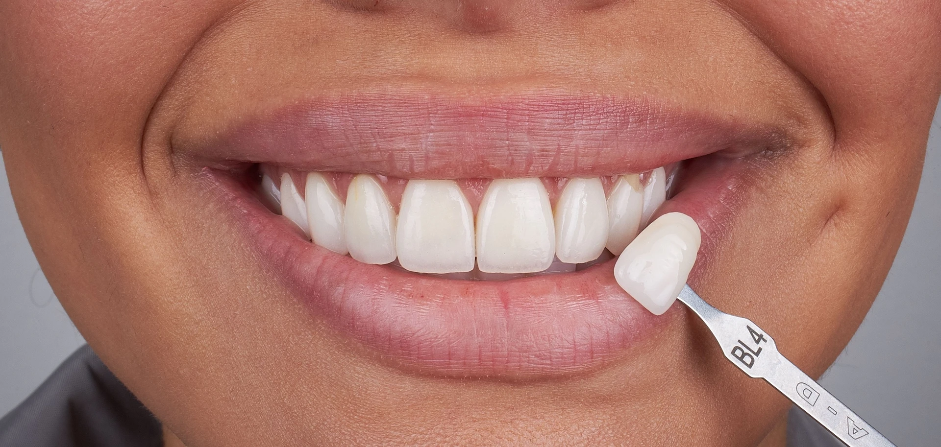 Cosmetic dentistry treatment