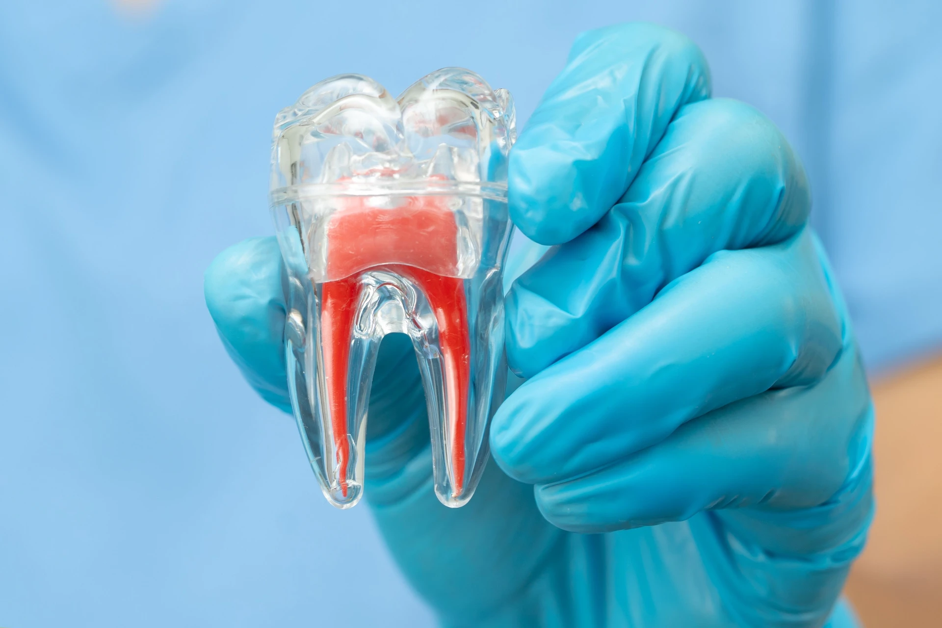 Endodontic care at Blue Dental