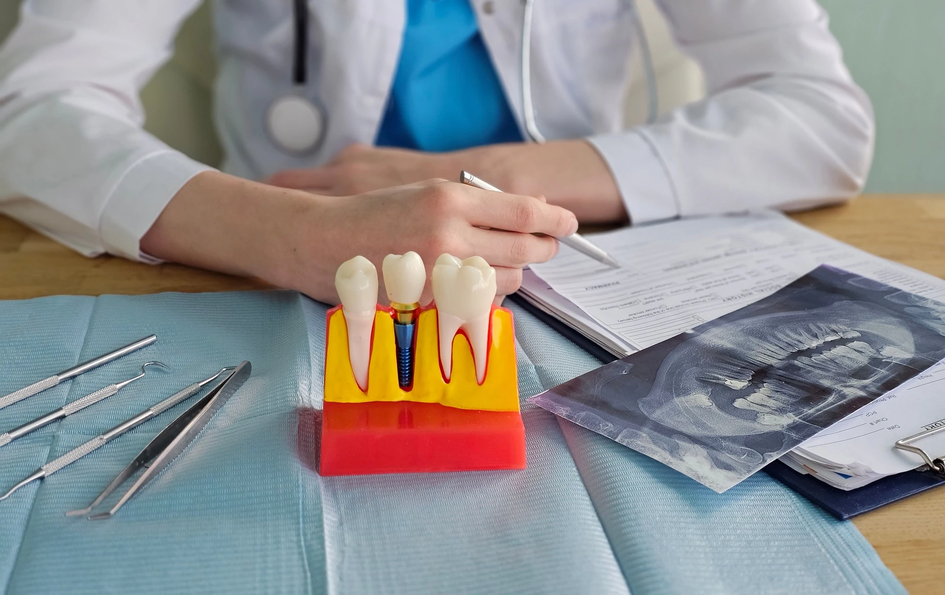Dental implant procedure