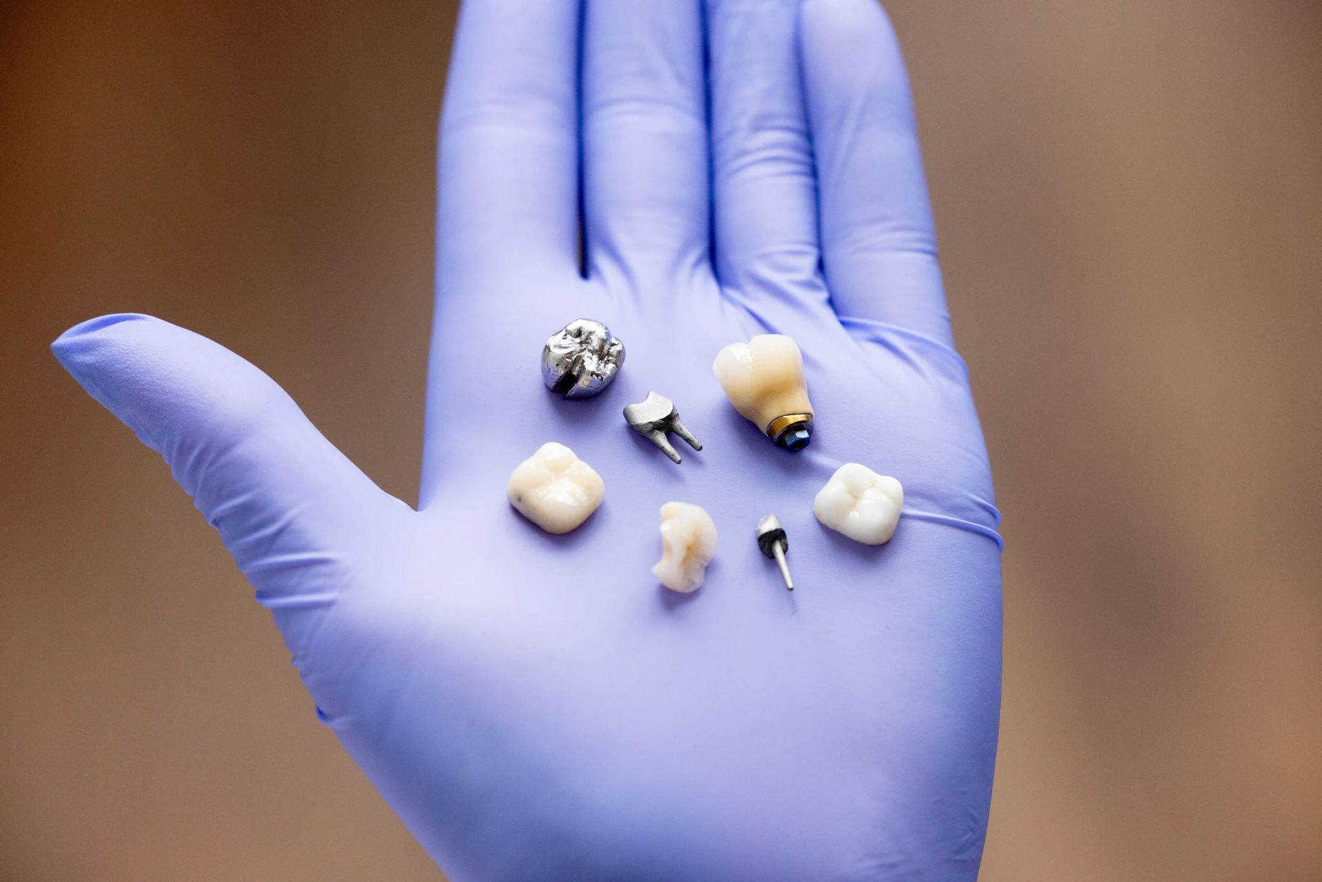 Restorative dentistry care
